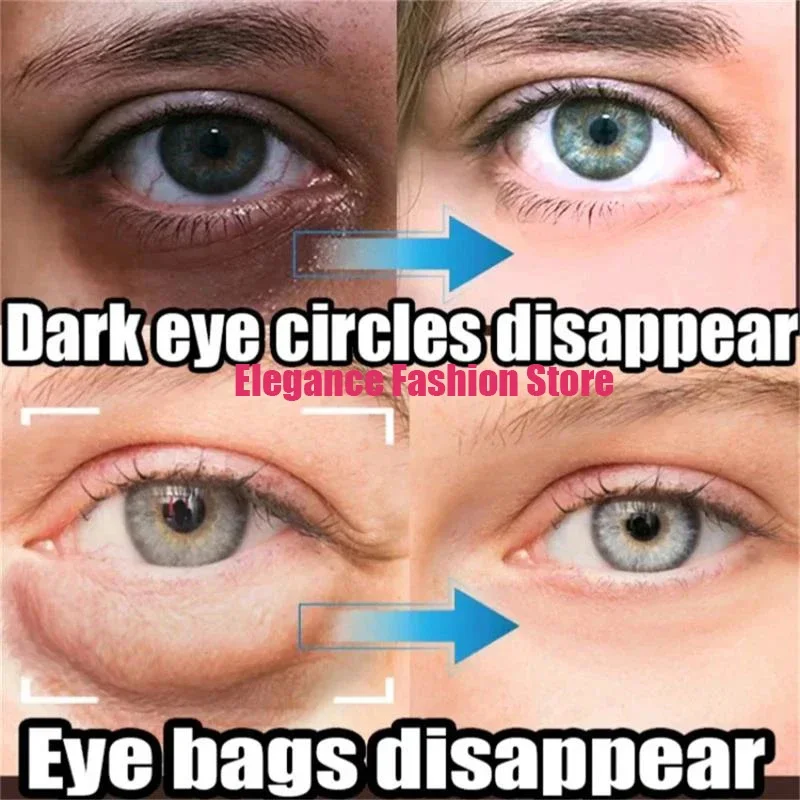 kf-S90b47453ca244894a44f54977fbd5910y.webp Crème anti-cernes instantanée pour les yeux, élimine les poches sous les yeux, les cernes, les poches, estompe les ridules, lifting, éclaircit, beauté coréenne – Image 3