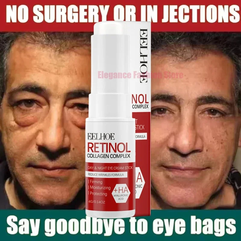 kf-Sbd9e4387059f466a855545535828641df.webp Crème anti-cernes instantanée pour les yeux, élimine les poches sous les yeux, les cernes, les poches, estompe les ridules, lifting, éclaircit, beauté coréenne – Image 2