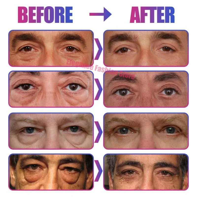 kf-Sc2d8b97152524f81b7700da9c16b35f46.webp Crème anti-cernes instantanée pour les yeux, élimine les poches sous les yeux, les cernes, les poches, estompe les ridules, lifting, éclaircit, beauté coréenne – Image 4